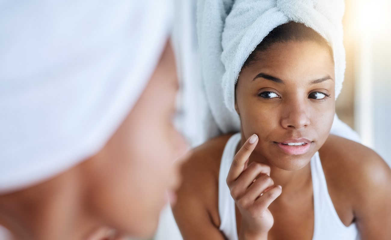 The Complete Guide to Clear Skin - Understanding and Treating Acne with 